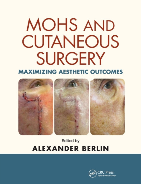 Book cover of: Mohs and Cutaneous Surgery. By: Alexander L. Berlin