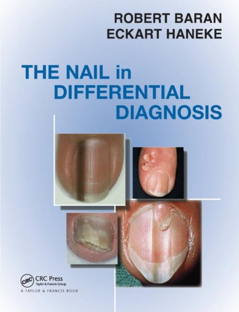 Book cover of: Nail in Differential Diagnosis. By: Robert Baran