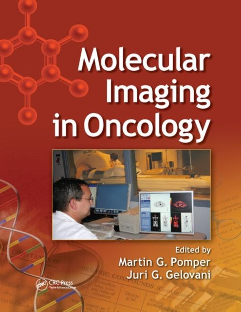 Book cover of: Molecular Imaging in Oncology. By: Martin G. Pomper