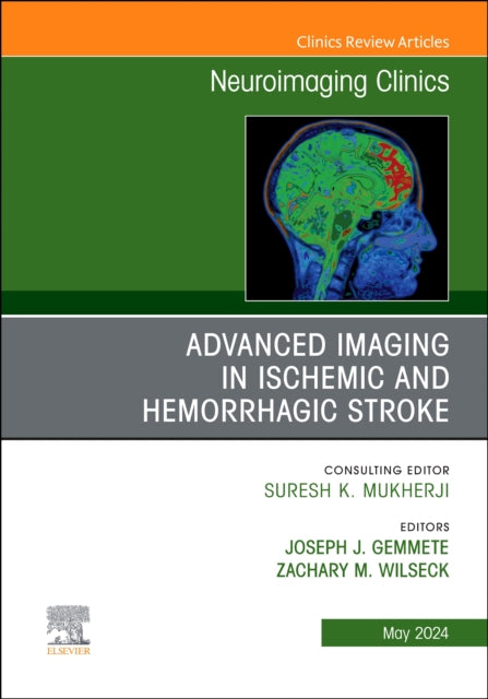 Book cover of: Advanced Imaging in Ischemic and Hemorrhagic Stroke, An Issue of Neuroimaging Clinics of North America. By: Joseph J. Gemmete