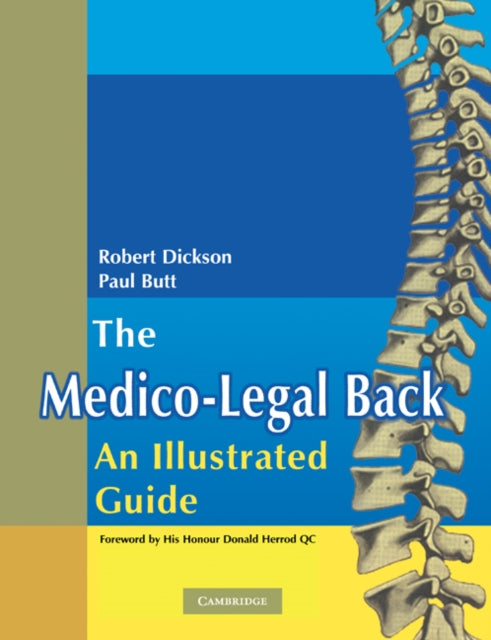 Book cover of: Medico-Legal Back: An Illustrated Guide. By: Robert A. Dickson