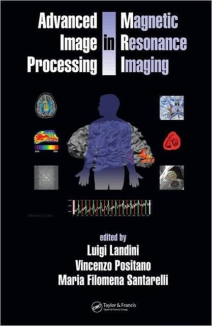 Book cover of: Advanced Image Processing in Magnetic Resonance Imaging