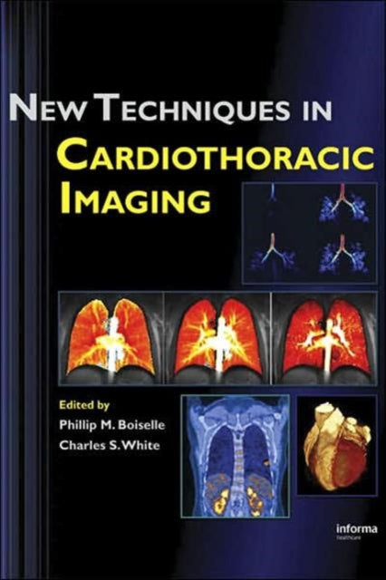 Book cover of: New Techniques in Cardiothoracic Imaging