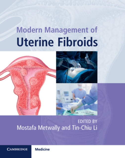 Book cover of: Modern Management of Uterine Fibroids. By: Mostafa Metwally