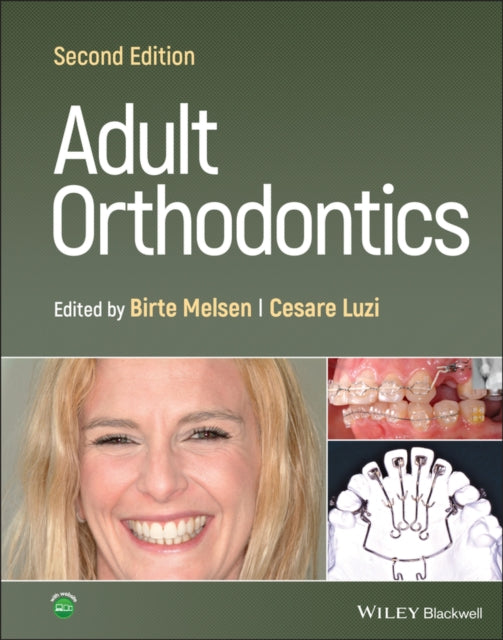 Book cover of: Adult Orthodontics. By: Birte Melsen