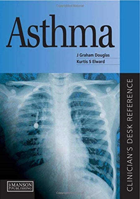 Book cover of: Asthma. By: J. Graham Douglas