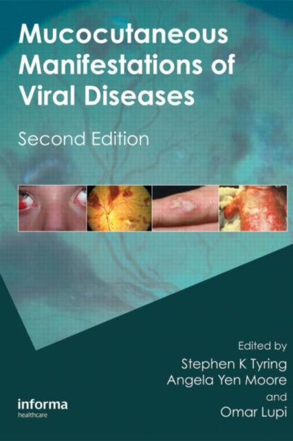 Book cover of: Mucocutaneous Manifestations of Viral Diseases