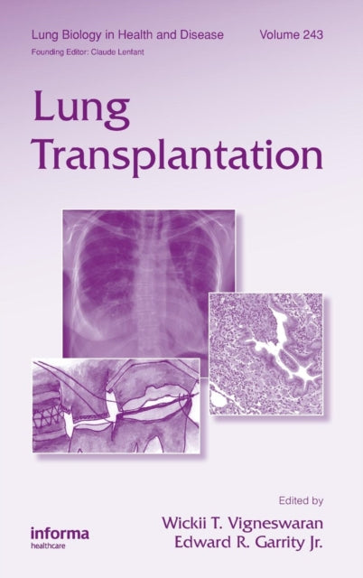 Book cover of: Lung Transplantation. By: Wickii T. Vigneswaran