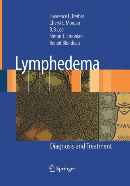 Book cover of: Lymphedema. By: Lawrence L. Tretbar