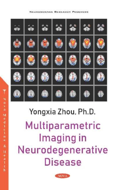 Book cover of: Multiparametric Imaging in Neurodegenerative Disease. By: Yongxia Zhou