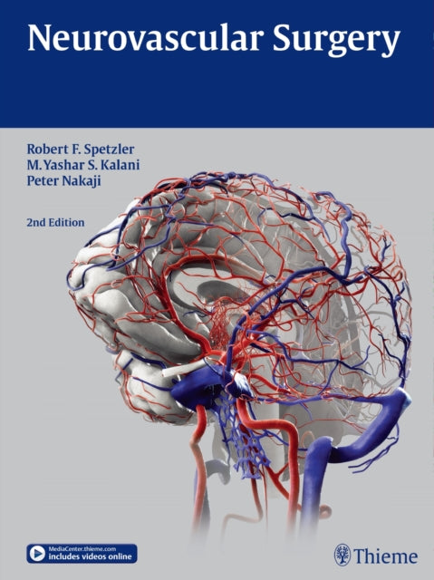 Book cover of: Neurovascular Surgery. By: Robert F. Spetzler