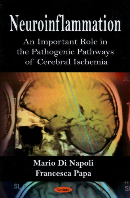 Book cover of: Neuroinflammation. By: Mario Di Napoli