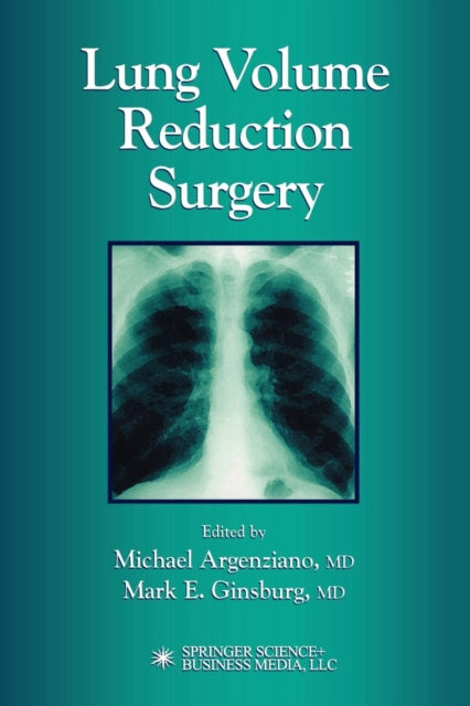 Book cover of: Lung Volume Reduction Surgery. By: Michael Argenziano