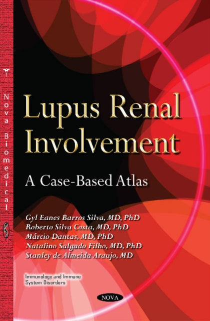 Book cover of: Lupus Renal Involvement. By: Gyl Eanes Barros Silva
