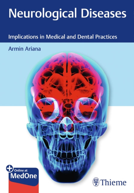 Book cover of: Neurological Diseases. By: Armin Ariana