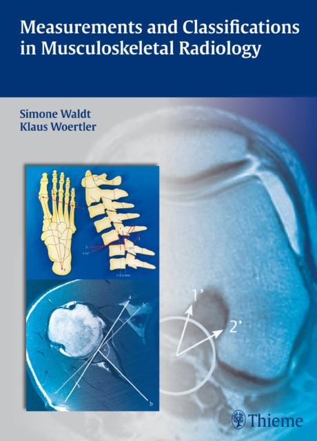Book cover of: Measurements and Classifications in Musculoskeletal Radiology. By: Simone Waldt