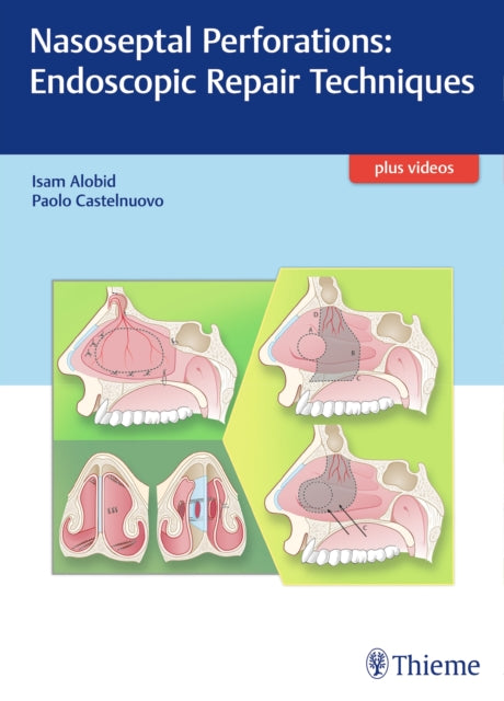 Book cover of: Nasoseptal Perforations: Endoscopic Repair Techniques. By: Isam Alobid