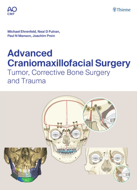 Book cover of: Advanced Craniomaxillofacial Surgery. By: Michael Ehrenfeld