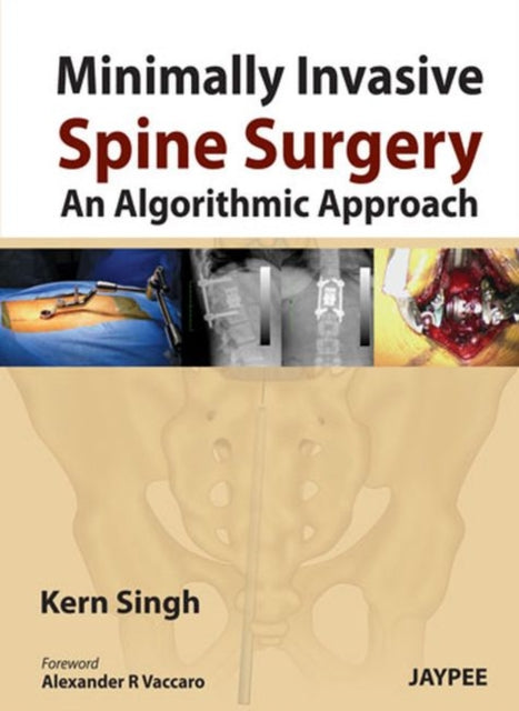 Book cover of: Minimally Invasive Spine Surgery: An Algorithmic Approach. By: Kern Singh