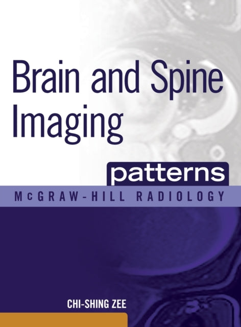 Book cover of: Brain and Spine Imaging Patterns. By: Chi S. Zee