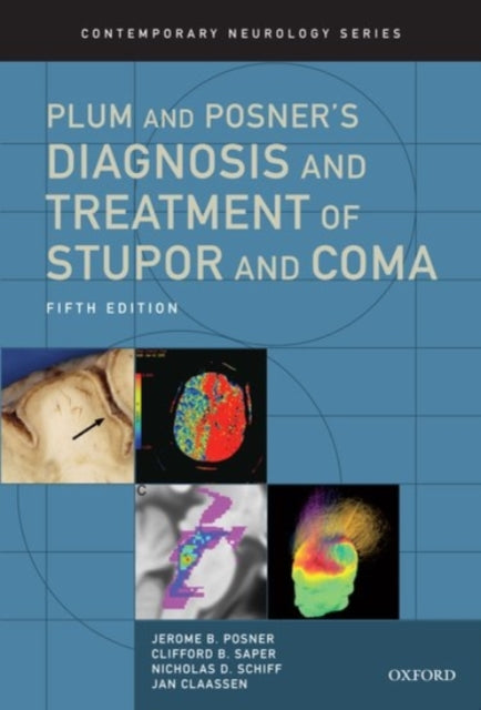 Book cover of: Plum and Posner's Diagnosis and Treatment of Stupor and Coma. By: Jerome B. Posner