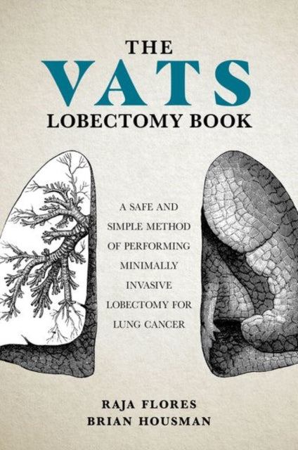 Book cover of: VATS Lobectomy Book. By: Brian Housman