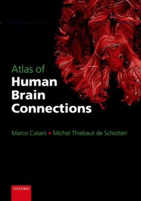 Book cover of: Atlas of Human Brain Connections. By: Marco Catani