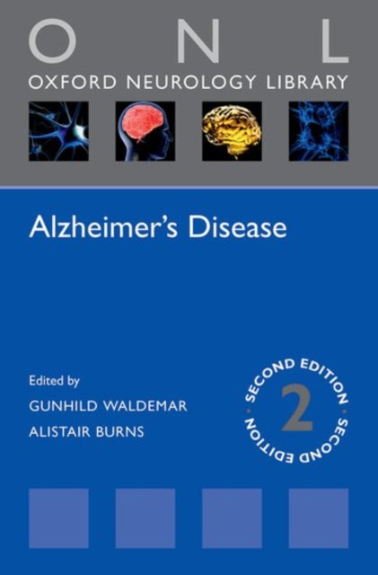 Book cover of: Alzheimer's Disease. By: Gunhild Waldemar