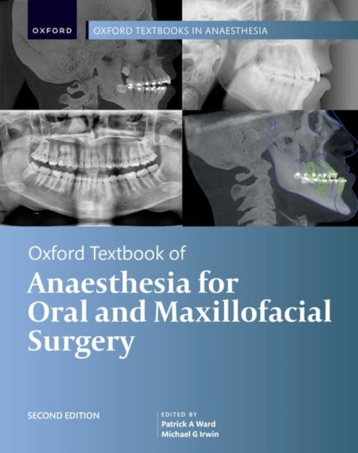 Book cover of: Oxford Textbook of Anaesthesia for Oral and Maxillofacial Surgery, Second Edition. By: Patrick A. Ward