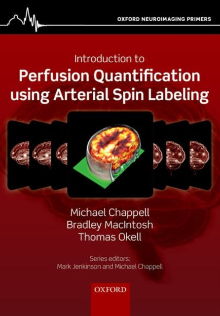 Book cover of: Introduction to Perfusion Quantification using Arterial Spin Labelling. By: Michael Chappell