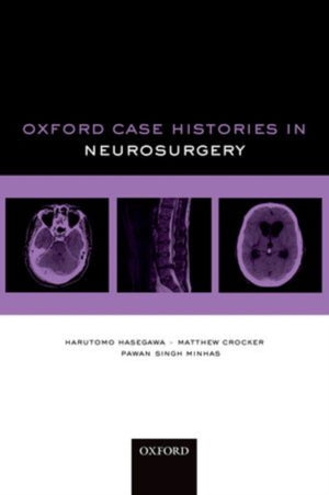 Oxford Case Histories in Neurosurgery