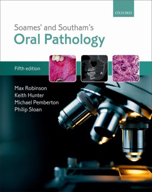 Book cover of: Soames' & Southam's Oral Pathology. By: Max Robinson