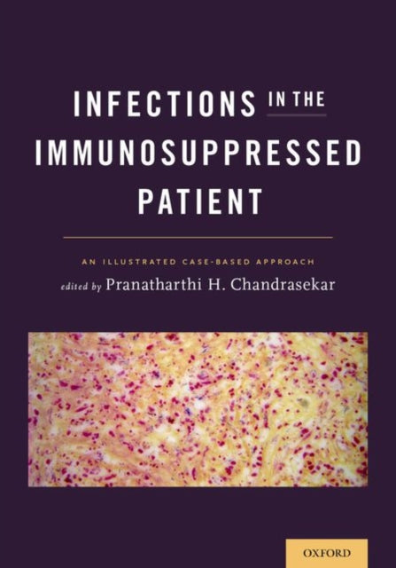 Book cover of: Infections in the Immunosuppressed Patient