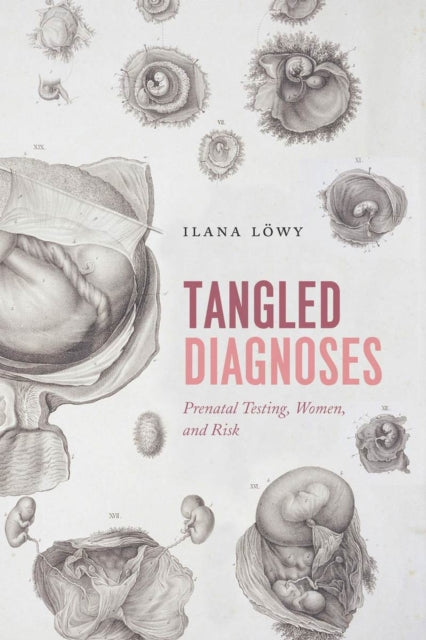 Book cover of: Tangled Diagnoses. By: Ilana Löwy