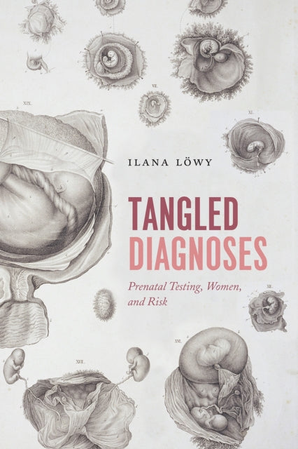 Book cover of: Tangled Diagnoses. By: Ilana Löwy