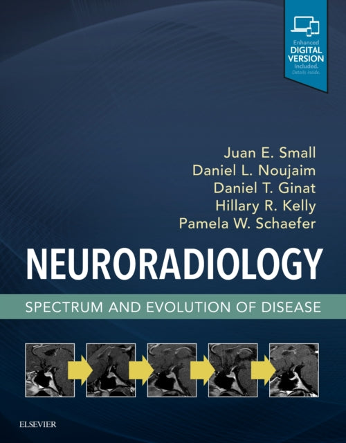 Book cover of: Neuroradiology: Spectrum and Evolution of Disease. By: Juan Small