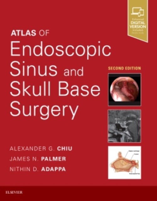 Book cover of: Atlas of Endoscopic Sinus and Skull Base Surgery. By: Alexander G. Chiu