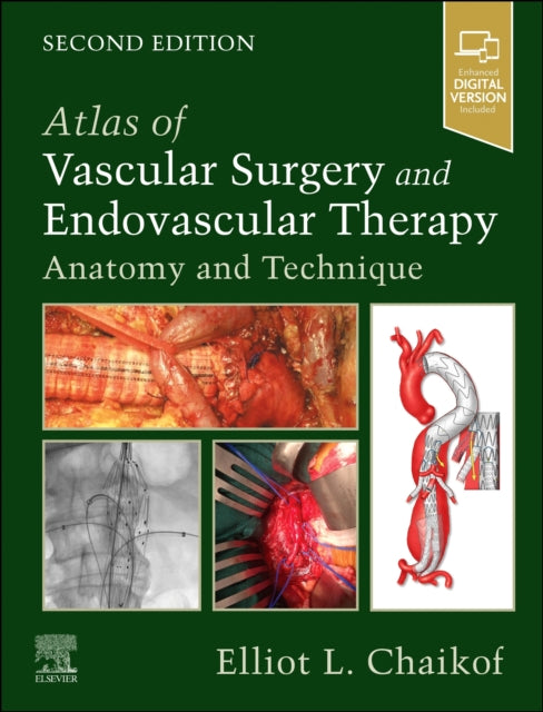 Book cover of: Atlas of Vascular Surgery and Endovascular Therapy. By: Elliot L. Chaikof