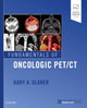 Book cover of: Fundamentals of Oncologic PET/CT. By: Gary A. Ulaner