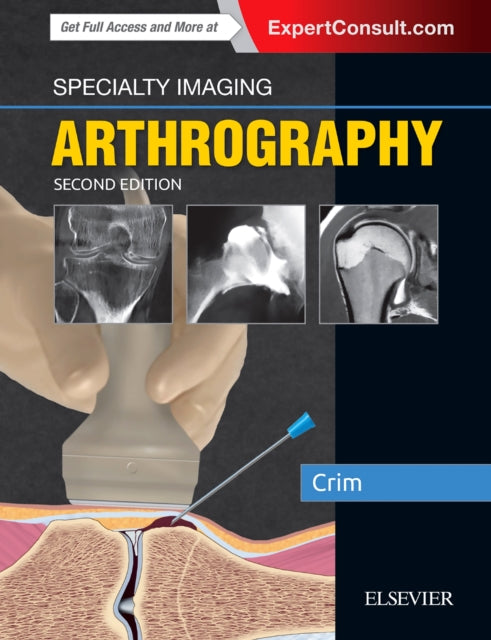 Book cover of: Specialty Imaging: Arthrography. By: Julia R. Crim