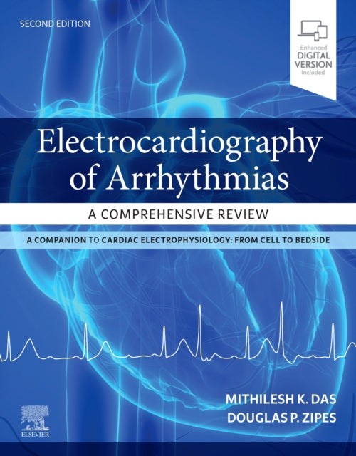 Book cover of: Electrocardiography of Arrhythmias: A Comprehensive Review. By: Mithilesh Kumar Das