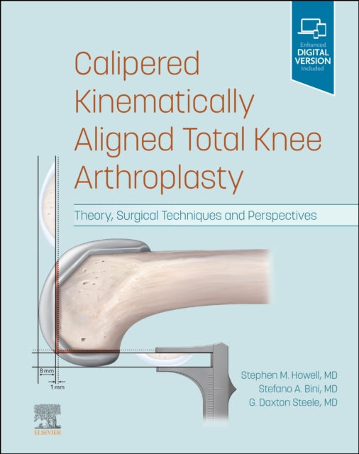 Book cover of: Calipered Kinematically aligned Total Knee Arthroplasty. By: Stefano A. Bini