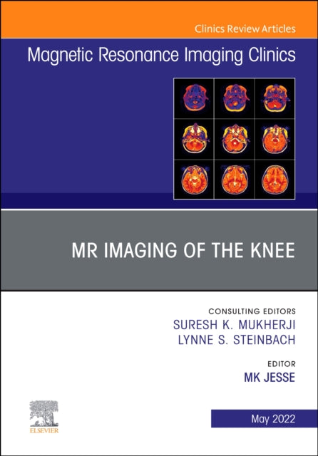 Book cover of: MR Imaging of The Knee, An Issue of Magnetic Resonance Imaging Clinics of North America. By: Mary K. Jesse