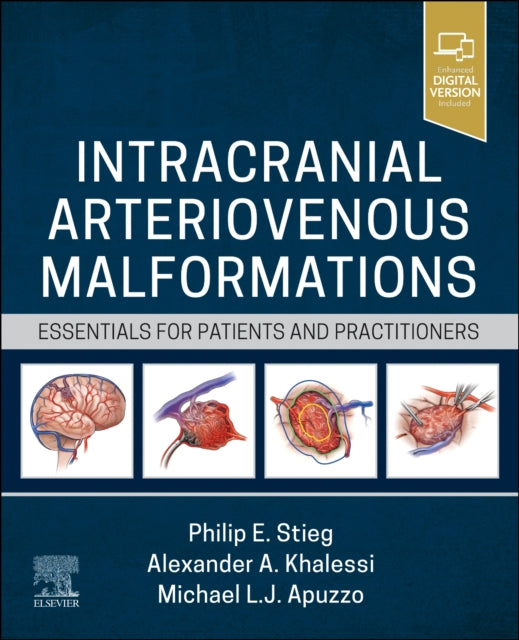 Book cover of: Intracranial Arteriovenous Malformations. By: Philip E. Stieg
