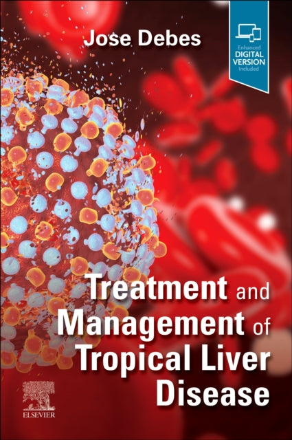 Book cover of: Treatment and Management of Tropical Liver Disease. By: Jose Debes