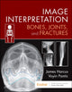 Book cover of: Image Interpretation: Bones, Joints, and Fractures. By: James Harcus