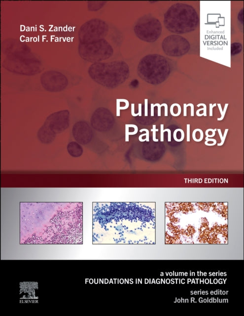 Book cover of: Pulmonary Pathology. By: Dani S. Zander