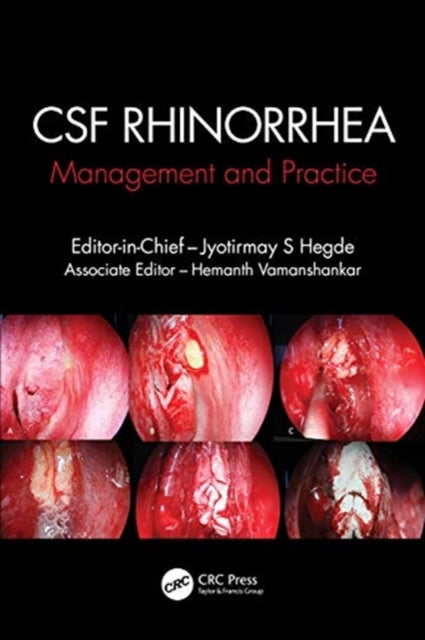 Book cover of: CSF Rhinorrhoea. By: Jyotirmay S. Hegde