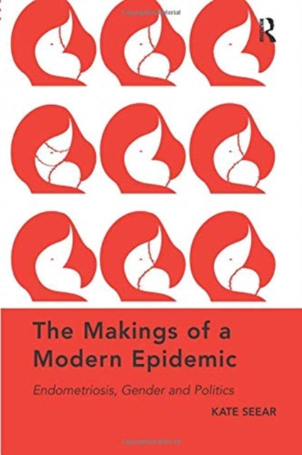 Book cover of: Makings of a Modern Epidemic. By: Kate Seear
