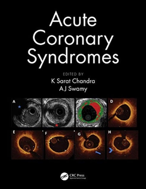 Book cover of: Acute Coronary Syndromes. By: K. Sarat Chandra
